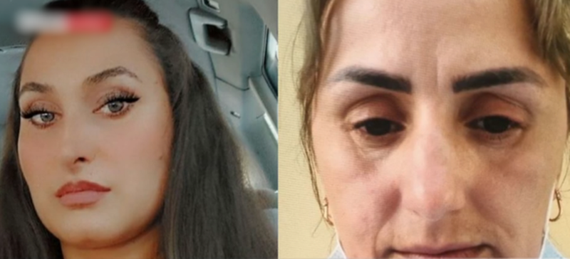 Infermierja që vidhte kartat e identitetit të pacientëve dhe merrte kredi në emër të tyre