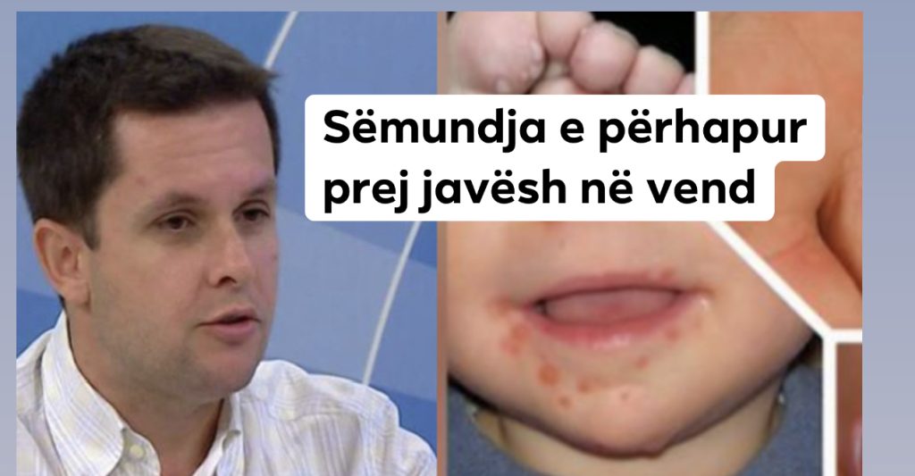Mjeku Alimehmeti: Kur prindërit shohin këto shenja tek fëmijët, mos t’i çojnë në kopësht e çerdhe