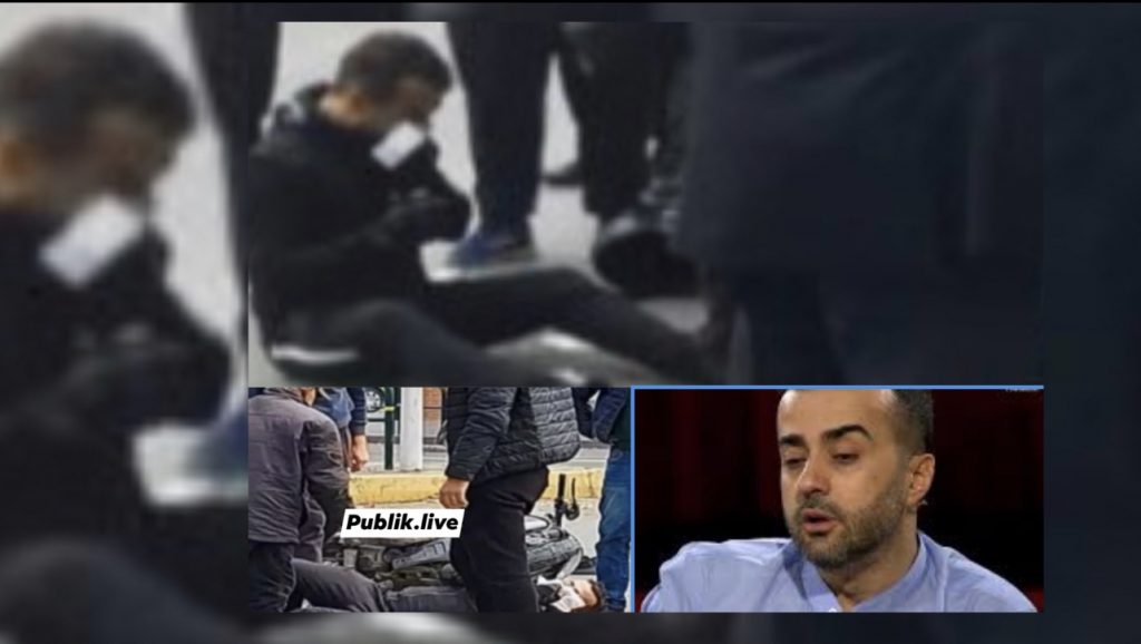 Aksidentohet aktori Gaz Paja në Tiranë, policia jep detajet e para