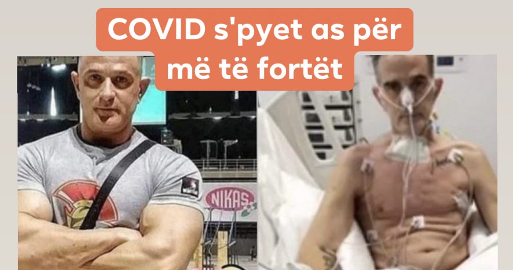 Shikoni si është transformuar kampioni i bodybuilding pas 2 muajsh në intubim (FOTO)