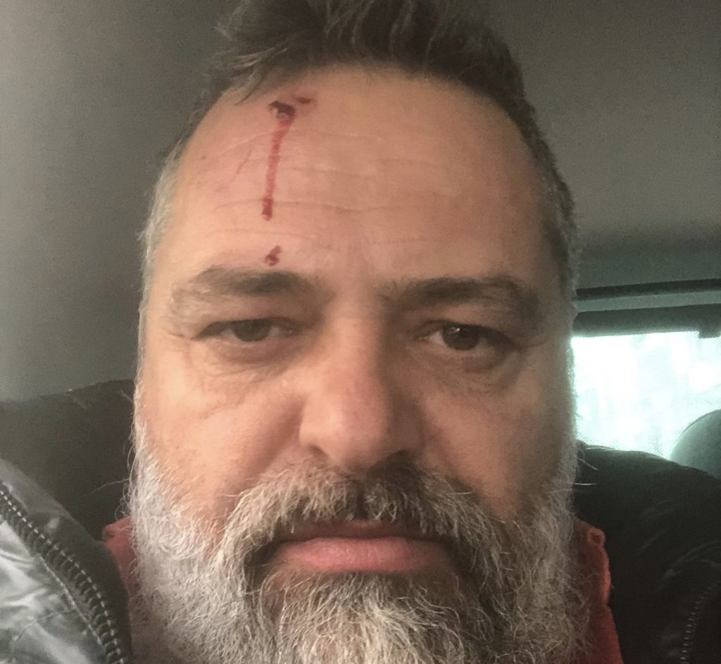 Noterja ‘kauboji’ Majlinda Lleshi godet gazetarin Genci Angjellarin dhe operatorin Gerd Hoxhën, policia ndihmon dhunuesen