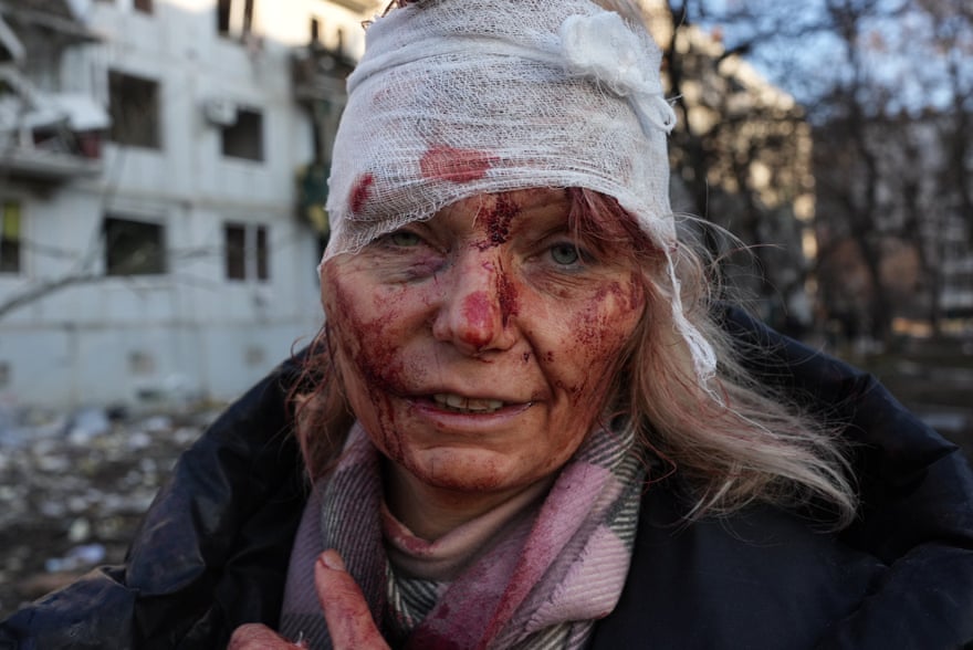 Ukraina do të mbijetojë, por Perëndimit duhet t’i vijë turp