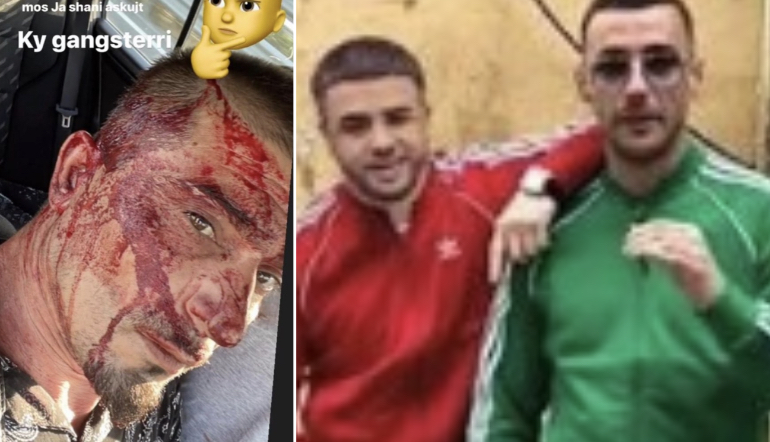 Stresi dhunon shokun e Cllevios që kërcënoi me jetë Noizy-n dhe nxjerr pamjet: Asgjë tjetër s’ka rëndësi