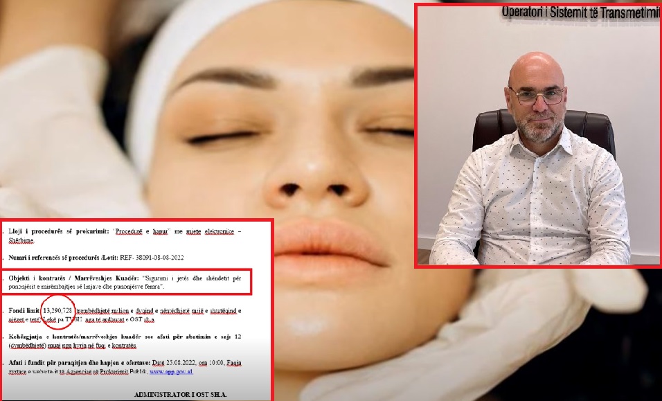 Tenderi i OST për trajtime estetike të punonjësve, qytetarët të shokuar: Qeveria të mendojë për popullin