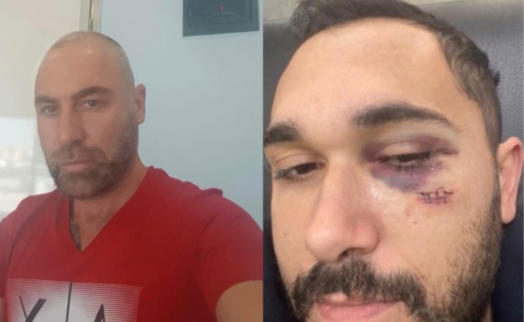 Edhe gratë do jua marrin!