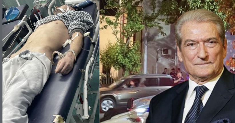 Berisha publikon foton e Leart Kurtit: Hematomat e shkaktuara nga goditjet!