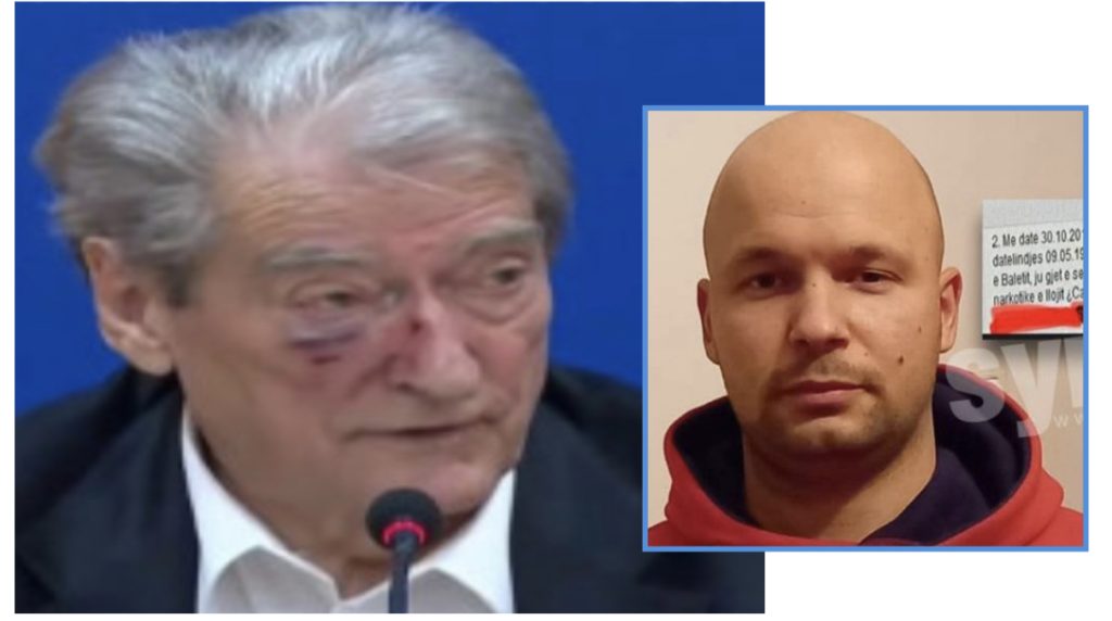 Flet doktori i 31-vjeçarit që sulmoi Berishën/ “Dokumenti i pacientit është autentik”