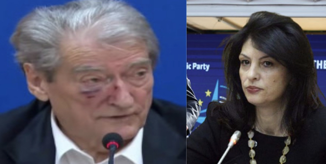 Topalli i del në mbrojtje Berishës: Ky agresion është vetëm politik