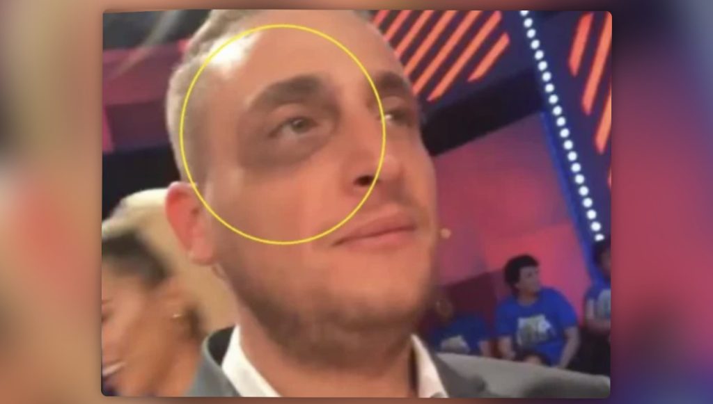 DOSJA PENALE/ Rezart Veleshnja sherr me grushte  për një vend parkimi