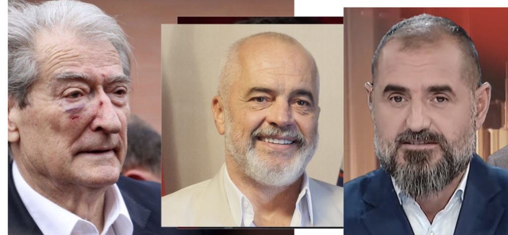 Pacienti Rama nuk është budalla, dje goditi në shenjë!