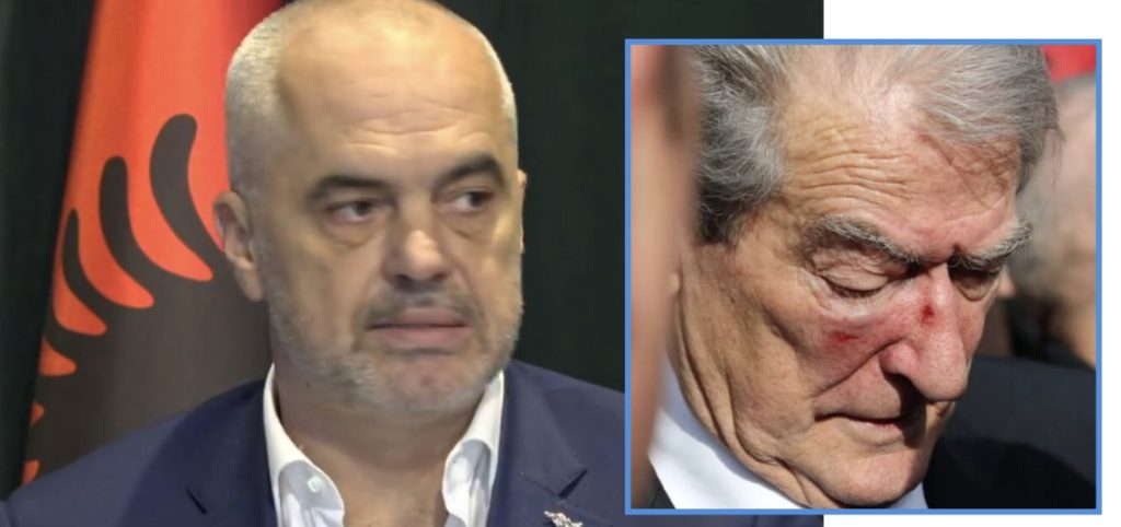 Goditja me grusht në protestë, reagon Rama: Dënoj dhunën, autori të përballet me ligjin