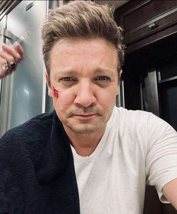Aktori Jeremy Renner në gjendje të rëndë: U  plagos teksa pastronte borën në shtëpinë e tij