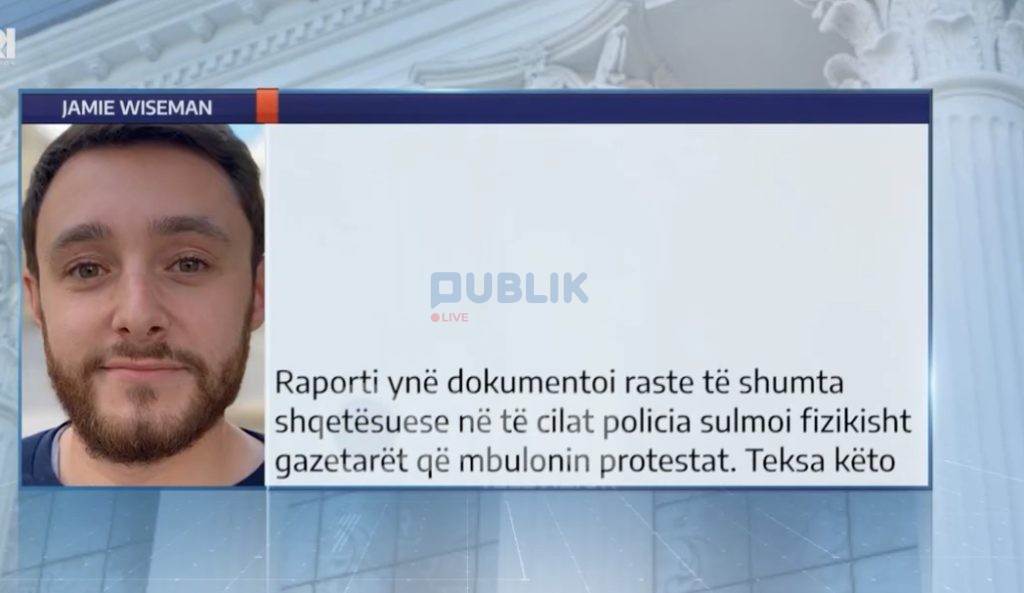 Liria e shtypit, ende sfiduese në Shqipëri’, Wiseman për DW: Gjuha denigruese e Ramës, kërcënim
