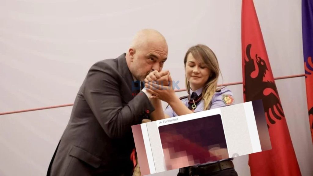 Efektivja që humbi gishtat në protestën e Astirit pjesë e komunikimeve seksiste të Policisë