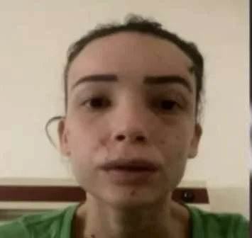 Rrëfimi i plotë i vajzës së rrahur mizorisht nga i dashuri: Më binte me drurin me gozhda