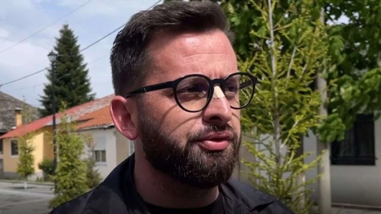 Hëngri grusht, Erion Isai: Më vjen keq për Kolonjën që do dalë në Google