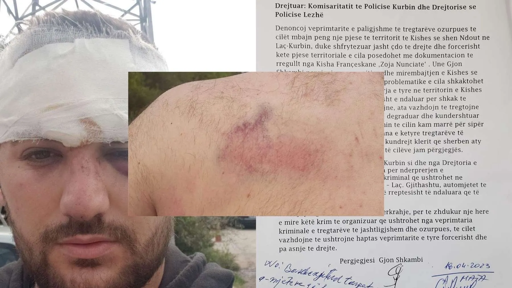 Sherr në Kishën e Laçit, rojet private konfliktohen me shitësit ambulantë