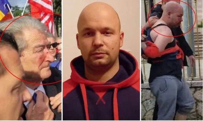 Goditi Berishën/ Prokuroria: Gert Shehun çojeni në psikiatri, jo në burg