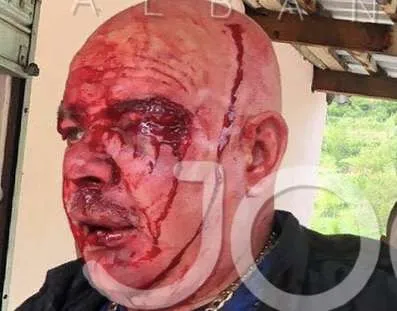 Sherr mes disa personave në Mirditë, plagoset një person