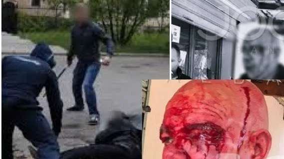 Sherri në Mirditë, 54-vjeçari u dhunua nga 4 vëllezërit