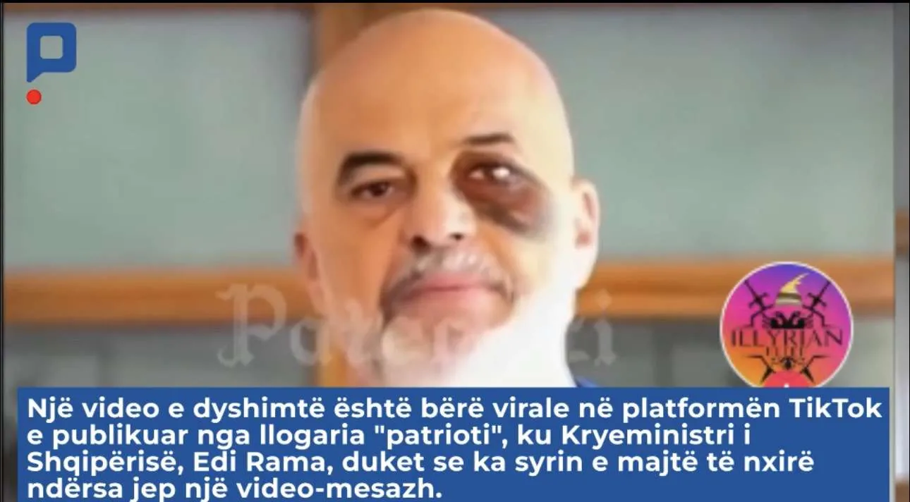 Syri i “mavijosur” i kryeministrit Rama në median turke
