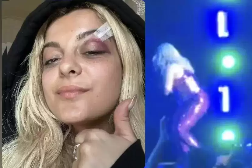 Bebe Rexha goditet me celular në fytyrë gjatë koncertit