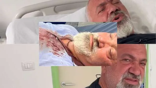 Policia e Delvinës fshehu ngjarjen e dhunimit të biznesmenit