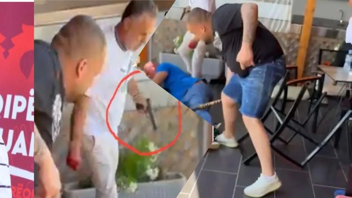 Dhuna barbare në Krujë, policia nuk arreston vëllezërit e deputetit të PS-së 