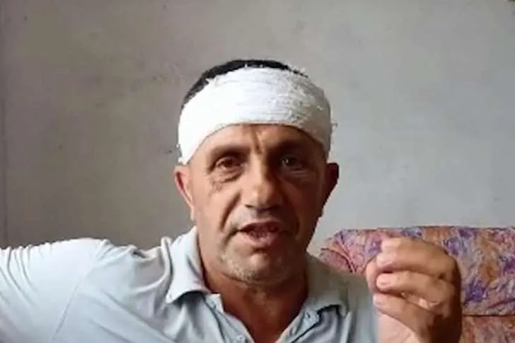Flet i dhunuari nga Rrajat/ Maja: Policia nuk më mori asnjë deklarim!