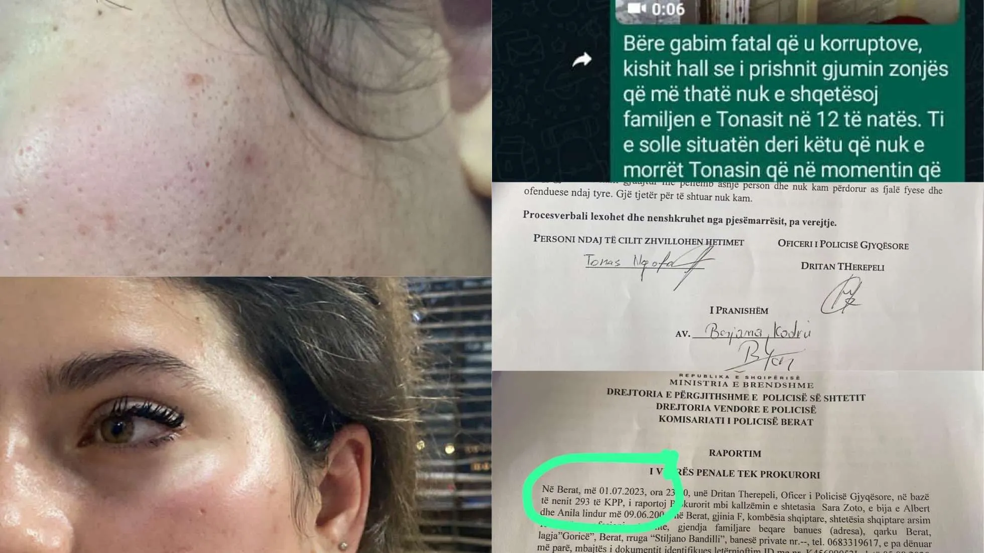 Berisha denoncon skandalin: Banditi rilindas që rrahu Sara Zoton dhe nënën e saj është i paprekshëm