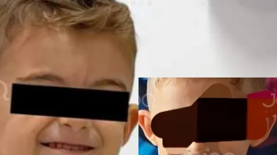 Tragjike/ Briani 3 vjeç ndërron jetë pasi shkoi tek dentisti, narkoza i helmoi mëlçinë