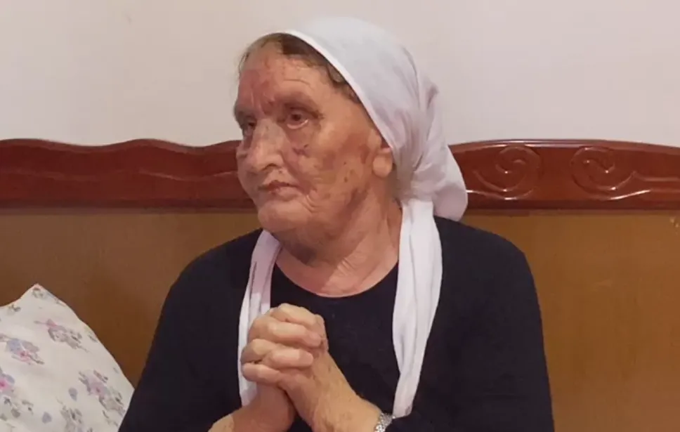 LUSHNJE/ U grabit dhe u dhunua nga dy të rinj, e moshuara rrëfen tmerrin: E quajta veten të vdekur