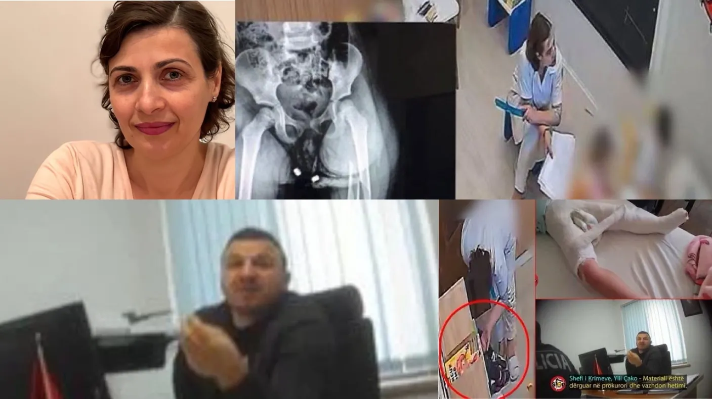 Si shefi i krimeve Ylli Çako, OPGJ dhe mjekësia ligjore mbulojnë dhunën ndaj 3 vjecares