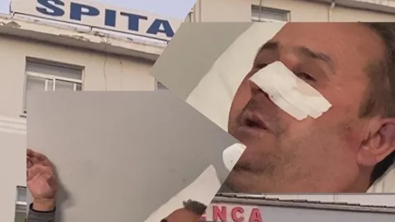 U dhunua nga hajdutët, flet i zoti i banesës: Më goditën në kokë, por nuk vodhën gjë