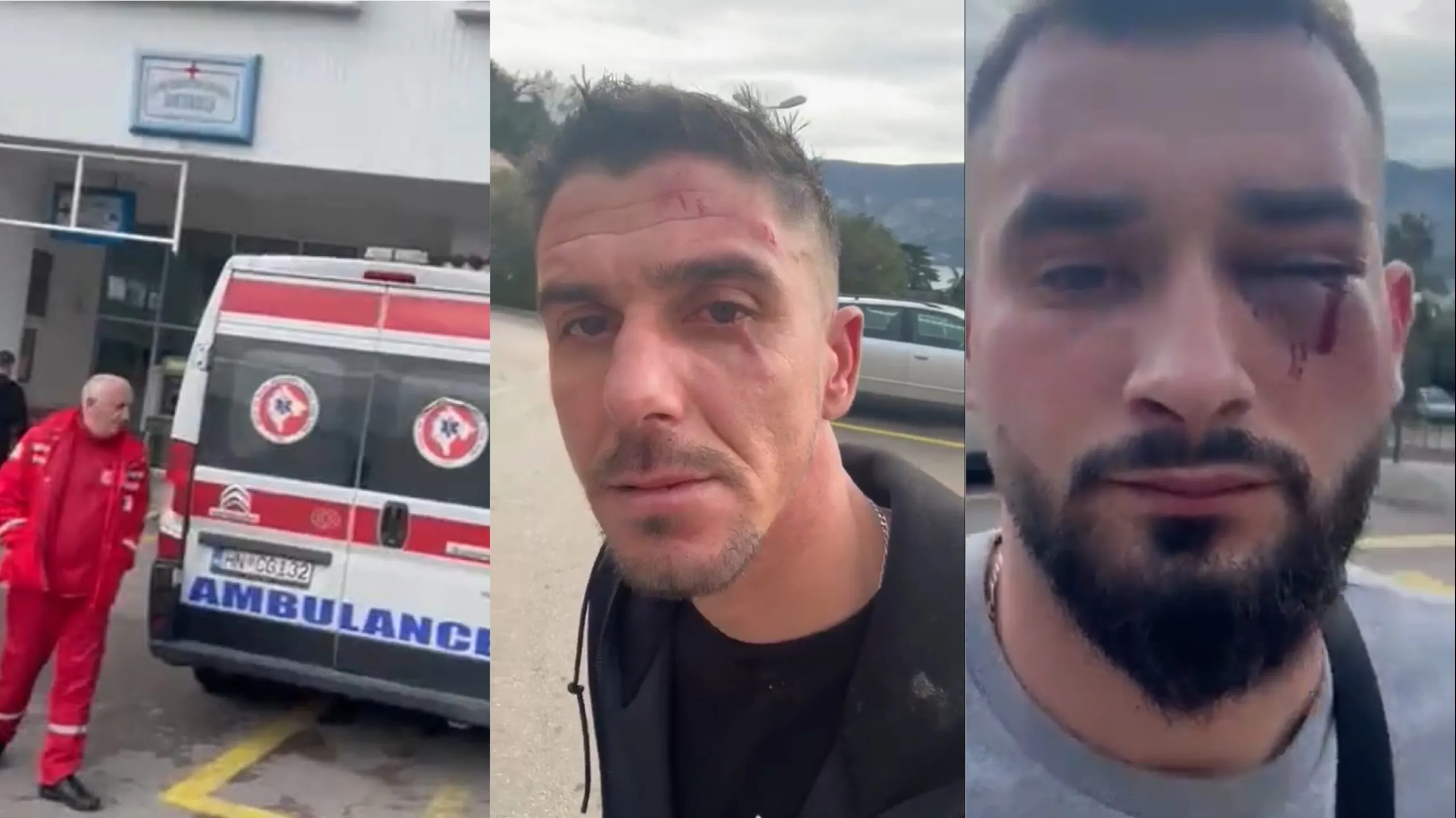 Policia shqiptare  jep informacion nga   dhunimi barbar i tre të rinjve në Mal të Zi : 7 persona ndaluan makinën dhe i goditën befasisht