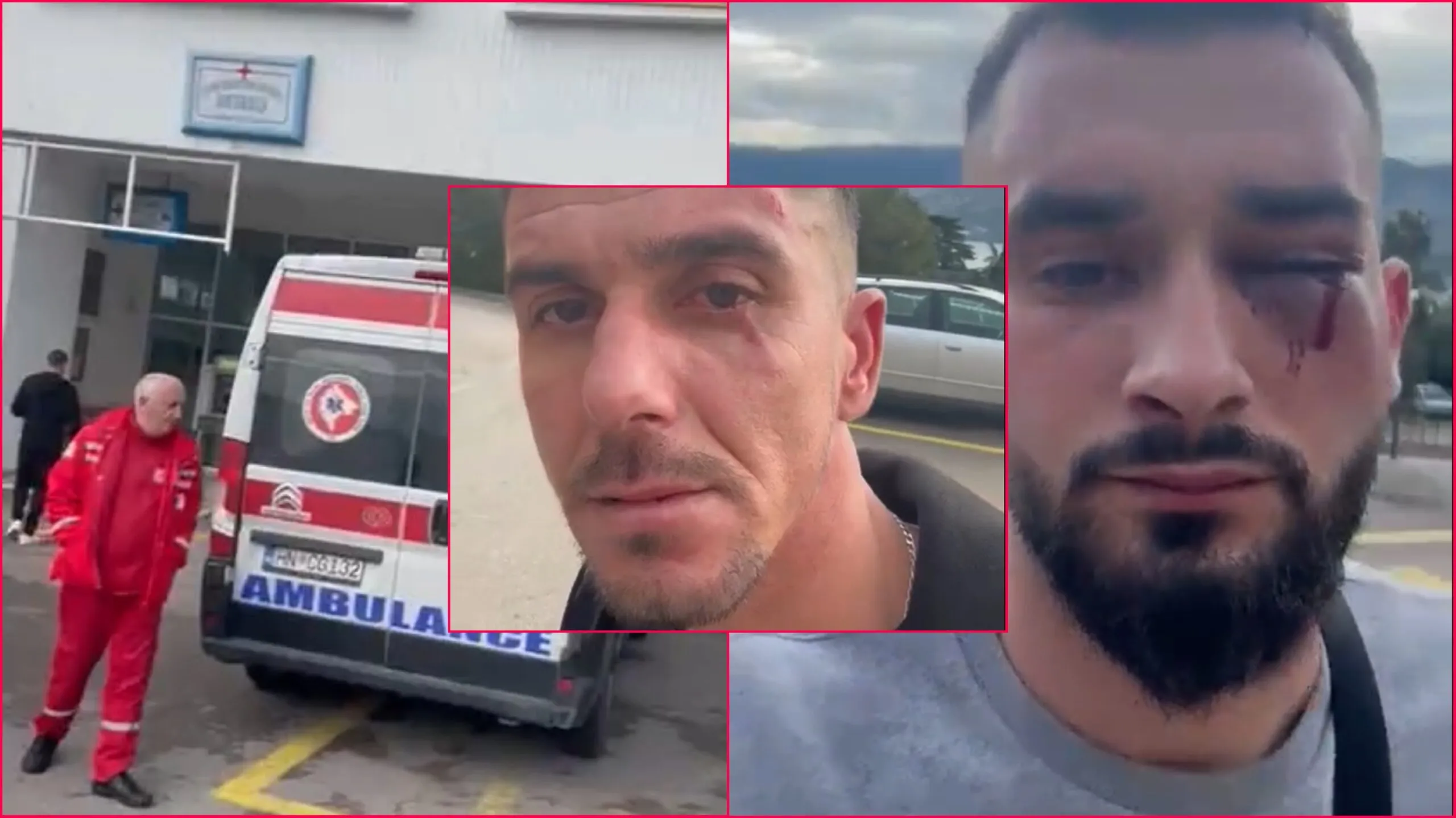 Dhunimi i tre shqiptarëve në Malin e Zi , policia malazeze identifikon autorët