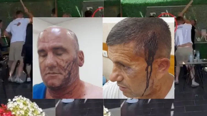 Gjykata e Tiranës fal dhunën  barbare të fisit RRAJA ndaj Bilbil dhe Jashar Majës