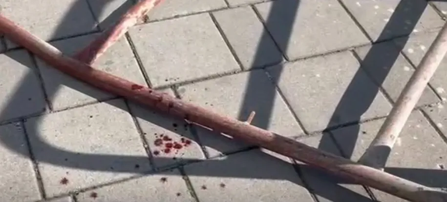 Rrëzimi i skelës/ Arrestohen punëtori, sipërmarrësi dhe inxhinieri i ‘Arlis’