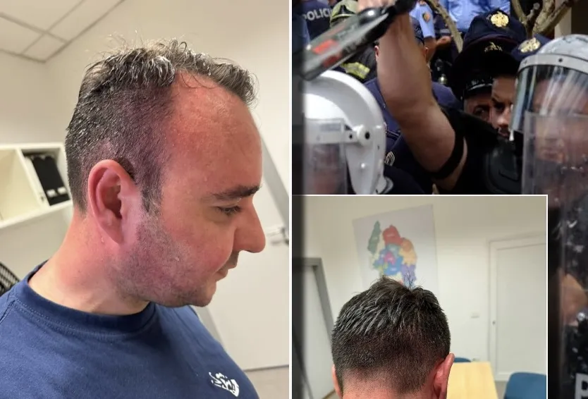 Policia u  hodhi lendë djegëse zyrtarëve të opozitës gjatë protestës para Bashkisë, Berisha: Dënoj me forcë këto akte kriminale! Këlliçi: Sjellje barbare e policisë