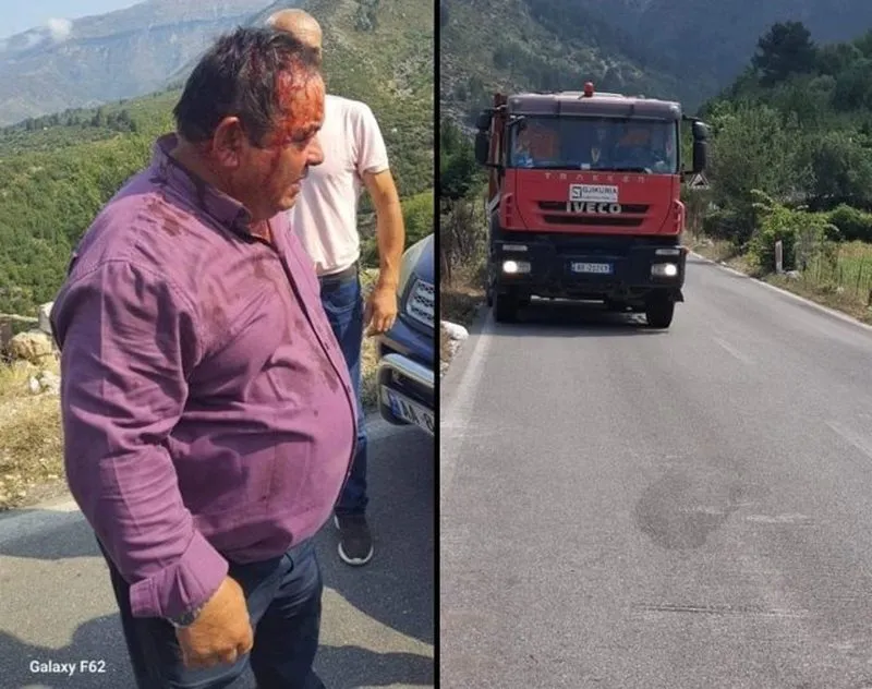 Vlorë/ I kapi duke gërmuar në tokën e tij pa leje, punonjësit e firmës “Gjikuria” rrahin banorin