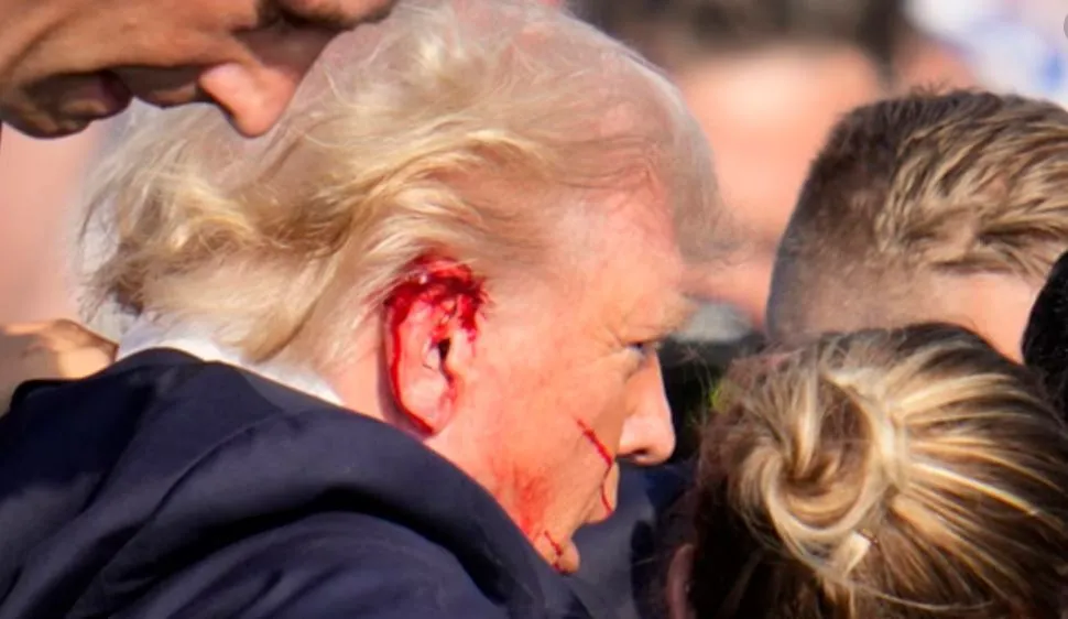 FBI i jep fund konfuzioneve: Donald Trump u godit vërtet nga plumbi