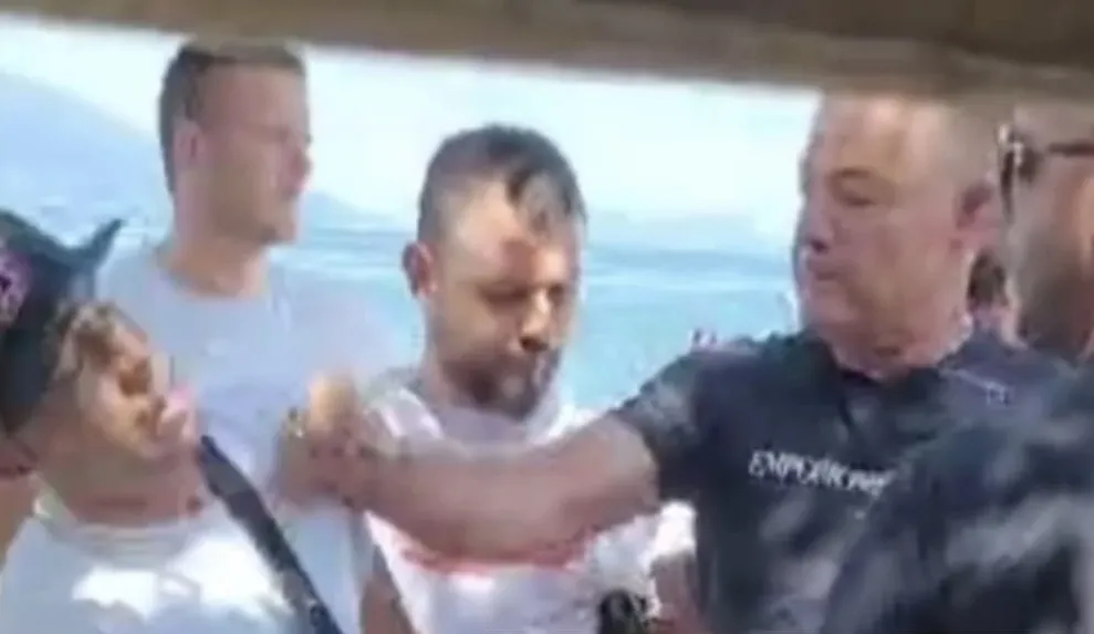 Pronari i hoteleve “Regina” pasi e godet qytetarin në sy të familjes del në një video si shok