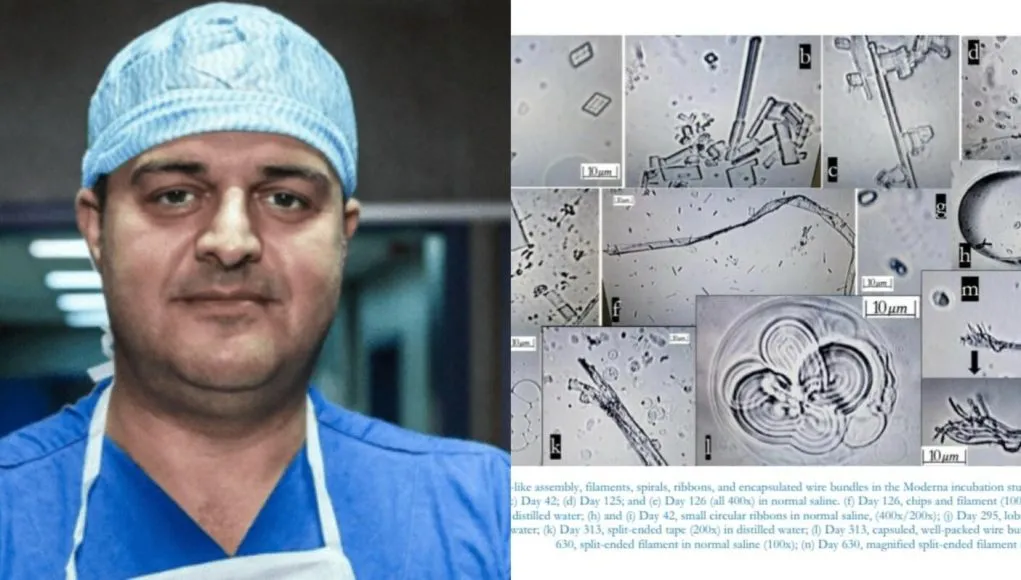 Edvin Prifti citon studimin: Vaksinat Pfizer e Moderna u kontaminuan në mënyrë nanoteknologjike, shkaktare të Turbo kancereve