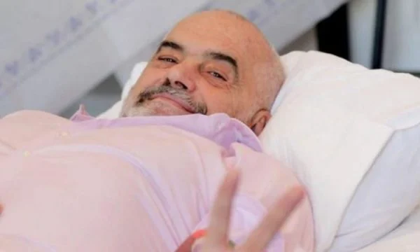 Edi Rama bën ndërhyrje  kirurgjikale
