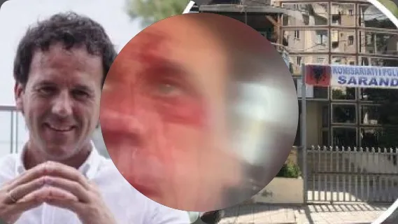 VIDEO/Pamje të rënda zbulojnë sulmin brutal ndaj biznesmenit Arben Çipa