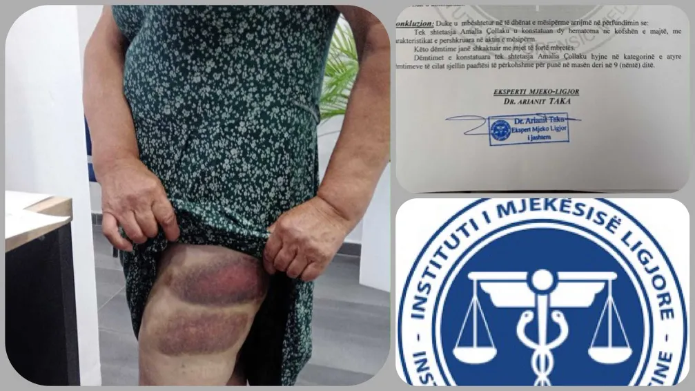 Skandali i Mjekësisë Ligjore: Institucioni mbulon krimin dhe dhunën ndaj gruas