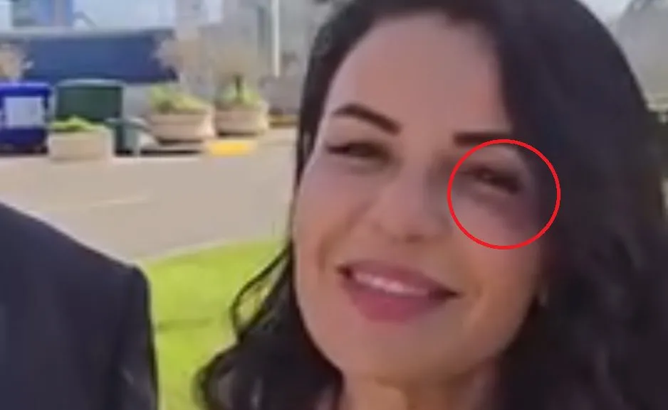 VIDEO VIRALE/ Kush ja nxiu syrin Belinda Ballukut?