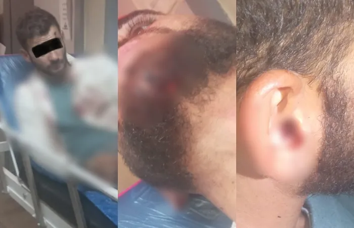 E kapën pa dokumente, shqiptari rrihet brutalisht nga policia greke