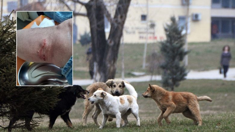 Qentë bëjnë namin në Klos, disa persona përfundojnë në spital