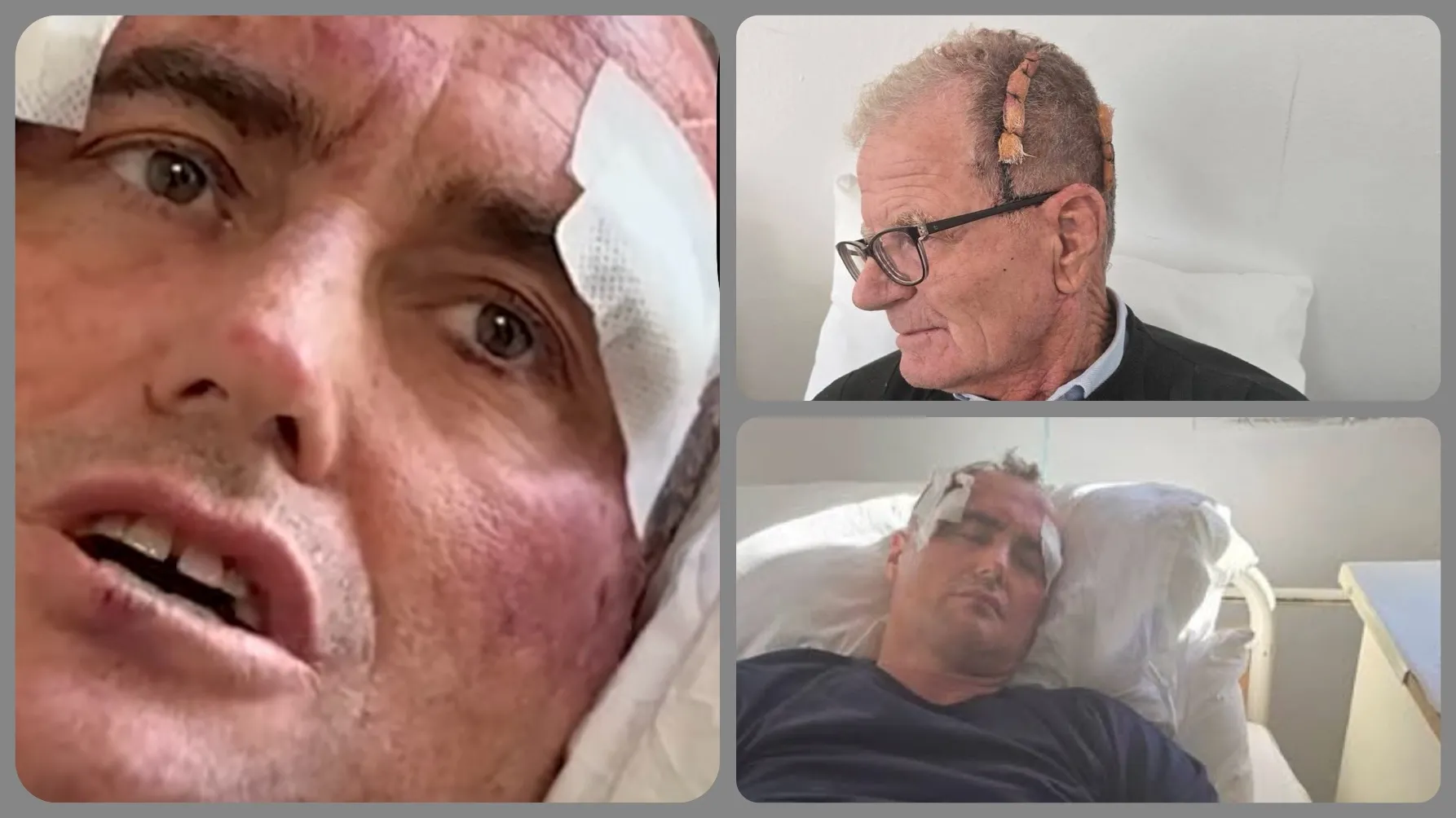 46 vjeçari i dhunuar bashkë me të atin akuzon policin e Fierit!